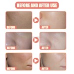 Whitening Vitamin C Serum Manufacturer - OEM/ODM Wholesale Private Label Pure