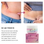 Stretch Mark Cream Manufacturer - OEM/ODM Wholesale Private Label Natural Organic