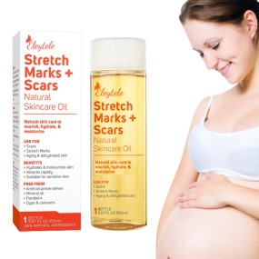 Stretch Mark Oil Manufacturer - OEM/ODM Private Label Natural Plant Regenerating Body