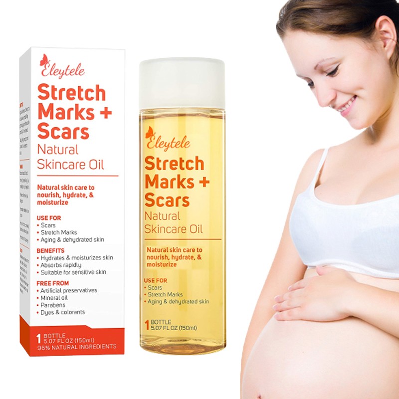 Stretch Mark Oil Manufacturer - OEM/ODM Private Label Natural Plant Regenerating Body