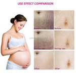 Stretch Mark Cream Manufacturer - OEM/ODM Wholesale Natural Maternity Private Label