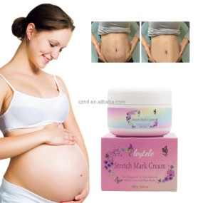 Stretch Mark Cream Manufacturer - OEM/ODM Wholesale Natural Maternity Private Label