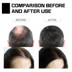 Batana Oil Shampoo Bar Manufacturer - OEM/ODM Private Label Organic Natural Herbal Handmade