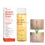 Stretch Mark Oil Manufacturer - OEM/ODM Private Label Best Natural Organic Skincare