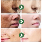 Exfoliating Gel Manufacturer - OEM/ODM Private Label Peeling Face Body Dead Skin Remover