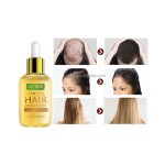 Hair Growth Oil Serum Manufacturer - OEM/ODM Wholesale Private Label Herbal Anti Loss
