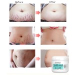 Stretch Mark Oil Cream Manufacturer - OEM/ODM Private Label Best Natural Body Care
