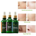 Tranexamic Acid Serum Manufacturer - OEM/ODM Wholesale Private Label Natural Organic Whitening