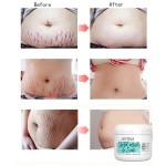 Stretch Mark Cream Manufacturer - OEM/ODM Natural Organic Postpartum Skin Repair