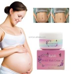 Stretch Mark Cream Manufacturer - OEM/ODM Private Label Skin Care Repair Organic Shea