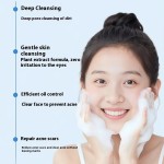 Face Cleanser Manufacturer - Customized Youth Oil Control Acne Removal