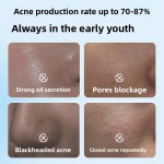 Face Cleanser Manufacturer - Customized Youth Oil Control Acne Removal