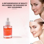 Whitening Serum Manufacturer - Korean 10% Niacinamide 4% TXA