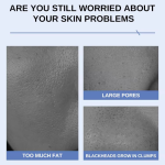 Night Cream Supplier - Hyaluronic Acid Capsule Collagen Filling