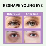 Eye Cream Supplier - OEM Retinol Hyaluronic Acid Dark Circles