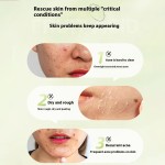 Facial Liquid Supplier - Organic Salicylic Acid Anti-Acne Purifying