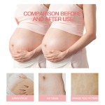 Stretch Mark Lotion Factory - Organic Essential Oil Scar Care