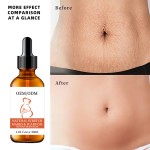 Body Oil Factory - Natural Organic Stretch Marks Removal Massage