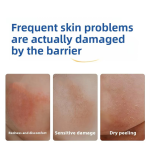 Baby Face Cream Manufacturer - Calendula Hydrating Balm Skin Care