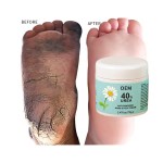 Foot Cream Manufacturer - OEM Urea Peptide Foot Care Repair Lotion