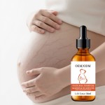 Body Oil Factory - Natural Organic Stretch Marks Removal Massage