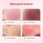 Children Cream Supplier - Customized Aloe Vera Anti-Chapped Face Cream