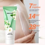 Body Lotion Factory - Private Label Firming Hyaluronic Acid Jasmine