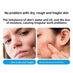 Face Cream Factory - OEM Custom B5 Acne Treatment Soothing