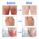 Joint Pain Relief Spray Manufacturer - Private Label South Moon 30ml Restorative Elbow