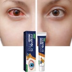 Propolis Eye Balm Manufacturer - Private Label Blueberry Muscles Relaxing Fatigue Reducing