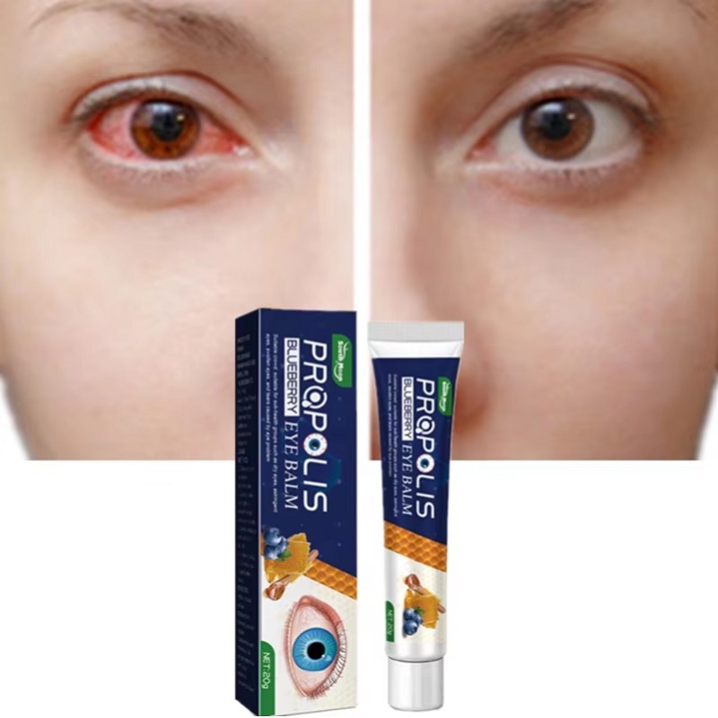 Propolis Eye Balm Manufacturer - Private Label Blueberry Muscles Relaxing Fatigue Reducing