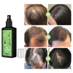 Hair Regrowth Spray Manufacturer - Private Label South Moon 100ml Green Ginger Loss Reducing