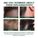 Hair Shampoo Manufacturer - OEM Private Label Anti Dandruff Seborrheic Dermatitis