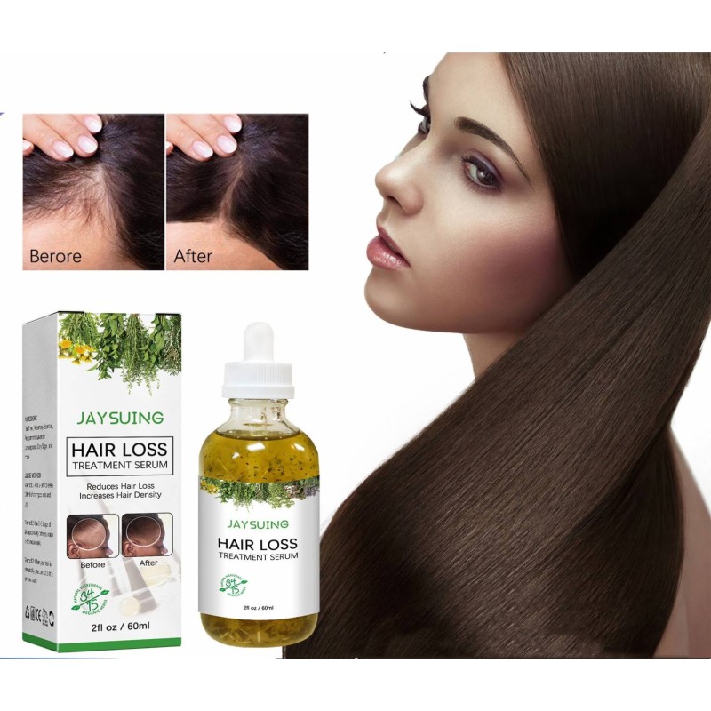 Hair Growth Oil Serum Manufacturer - OEM Hot Selling Private Label 100% Natural Nourishing