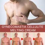 Male Breast Cream Manufacturer - OEM South Moon Gynecomastia Cellulite Melting Chest