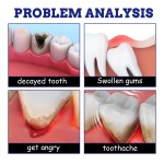 Toothache Spray Manufacturer - OEM Private Label Oral Hygiene Gingival Swelling Relief