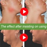 Neck Lymph Detox Patches Manufacturer - Private Label 12pcs Ginger Oil Red Clover Wormwood