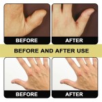 Ear Massage Device Manufacturer - OEM 1pair Silicone Acupoint Tinnitus Relief Sleep