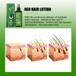 Hair Regrowth Spray Manufacturer - Private Label South Moon 100ml Green Ginger Loss Reducing