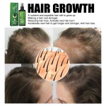 Hair Regrowth Spray Manufacturer - Private Label South Moon 100ml Green Ginger Loss Reducing