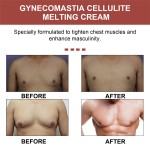 Male Breast Cream Manufacturer - OEM South Moon Gynecomastia Cellulite Melting Chest