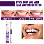 Tooth Whitening Pen Manufacturer - OEM/ODM Wholesale Private Label Purple Toner Cleaning