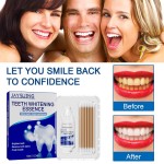 Tooth Whitening Essence Manufacturer - Private Label Oem Custom Clean Tartar Fresh Breath