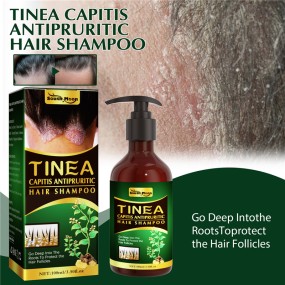 Hair Shampoo Manufacturer - OEM Private Label Anti Dandruff Seborrheic Dermatitis