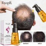 Hair Growth Oil Manufacturer - Private Label Moroccan Dry Damaged Hair Repairing Serum