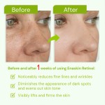 Wrinkle Removal Serum Manufacturer - OEM Stock Wholesaler Fast Anti Aging for Face Neck