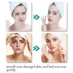 Turmeric Facial Cream Manufacturer - OEM Free Sample Private Label Niacinamide Salicylic Acid