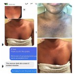 Inner Thigh Lightening Cream Manufacturer - OEM Private Label Dark Spots Eraser Bikini Whitening