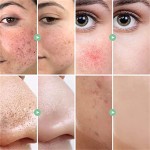 Salicylic Acid Cleanser Manufacturer - OEM TOP Oil Free Pink Grapefruit Anti Acne Shrink Pores