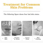 Salicylic Acid Cleanser Manufacturer - OEM TOP Oil Free Pink Grapefruit Anti Acne Shrink Pores